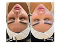 فیشال